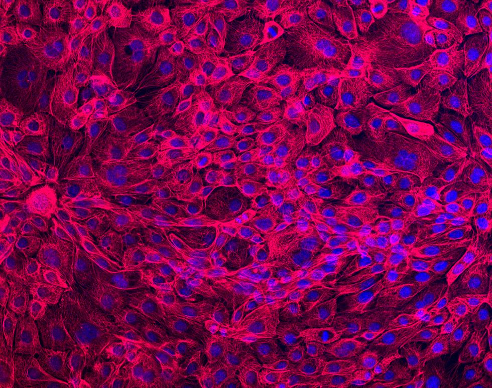 Epithelial Cells - Hussain Al-Malki